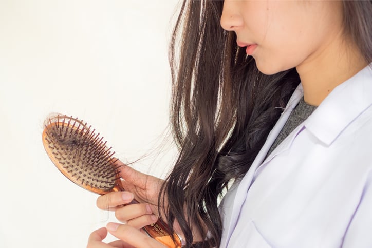 alopecia-femenina